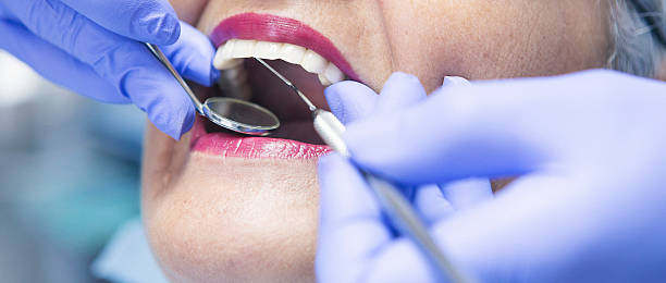 Best Emergency Dental Care for Sports Injuries in Denver, NC